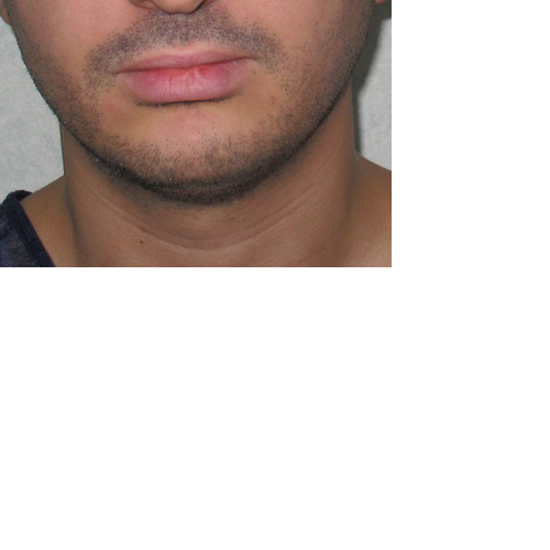 même patient de face