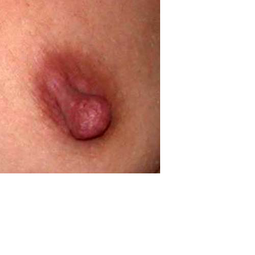 chirurgie-esthetique-interventions-seins-reduction-mamelon-00