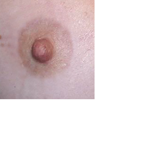 chirurgie-esthetique-interventions-seins-correction-mamelons-ombiliques