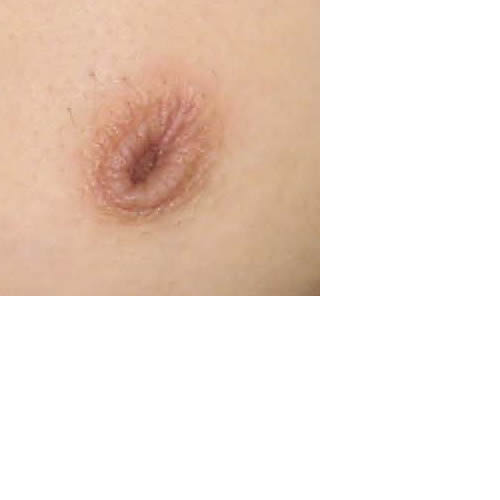 chirurgie-esthetique-interventions-seins-mamelons-ombiliques