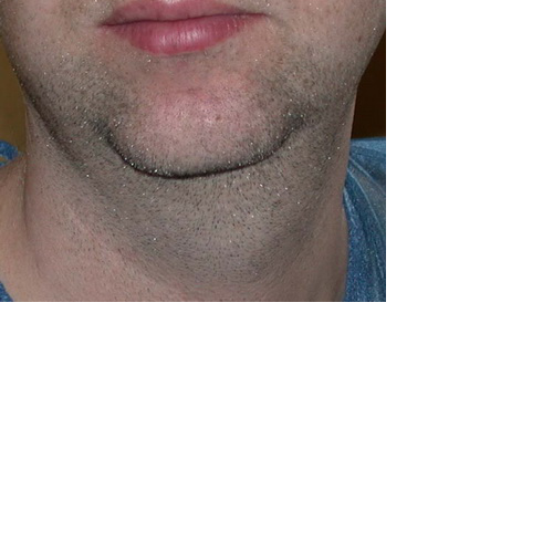 même patient de face